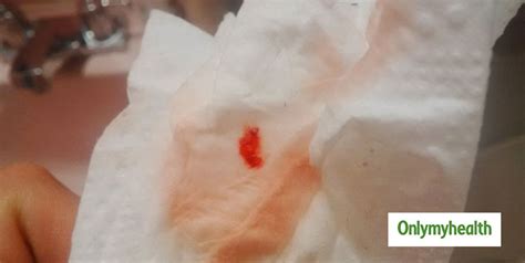 Implantation Bleeding Color