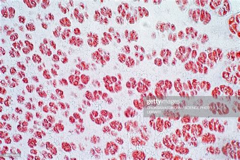 Human And Cartilage Bone Light Micrograph High Res Stock Photo Getty