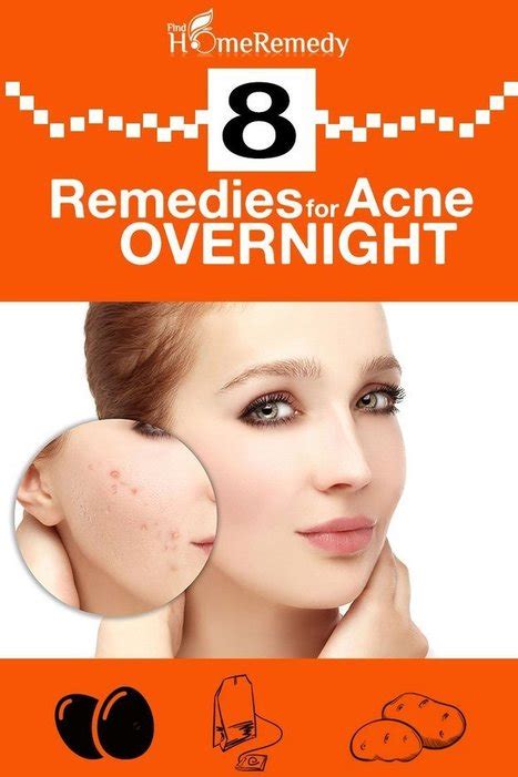 8 Home Remedies For Acne