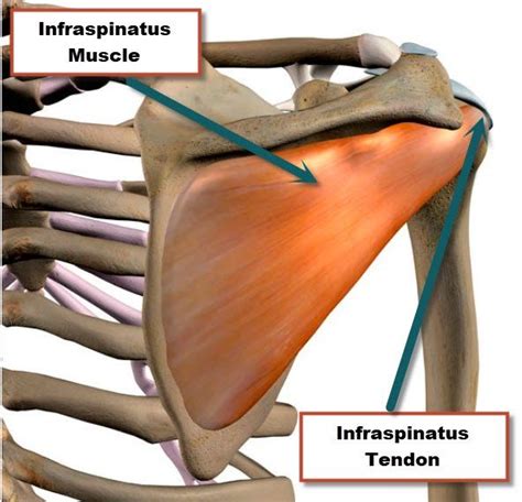 Infraspinatus Muscle Origin And Insertion