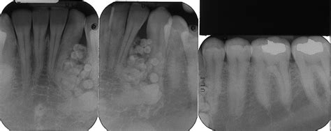 Dr Gs Toothpix An Oral Radiology Source For Dental Professionals