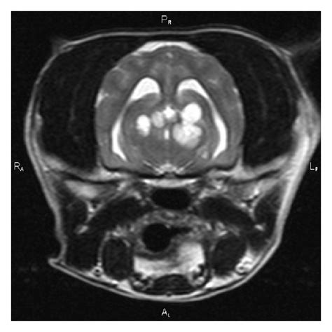 Figure 1 Canine Choroid Plexus Tumor With Intracranial Dissemination