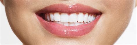 Cosmetic Dentist Miami Teeth Whitening Miami Lp Dental And Cosmetic