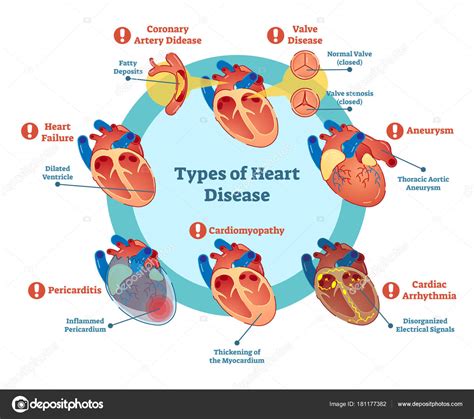 Free Free Heart Disease Svg 291 SVG PNG EPS DXF File