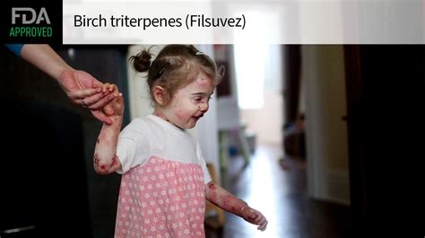 Topical Treatment For Epidermolysis Bullosa Wins Fda Approval Medpage