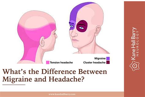 Whats The Difference Between Migraine And Headache Kane Hall Barry