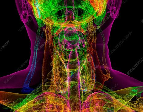 Human Neck Anatomy 3d Ct Scan Stock Image C0345261 Science