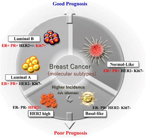 Different Molecular Subtypes Of Breast Cancer Download Scientific