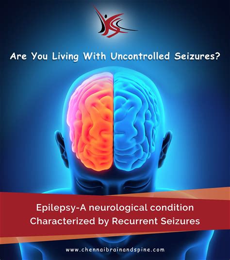 Epilepsy A Neurological Condition Characterized By Recurrent Seizures