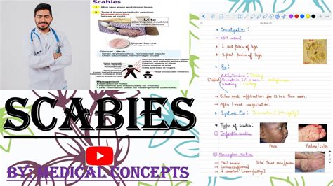 Scabies Parasitic Infection Dermatology Youtube