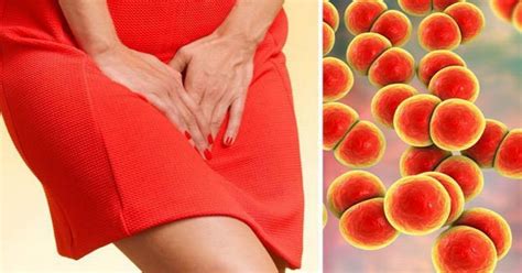 Gonorrhoea Symptoms Super Gonorrhoea Alert In The Uk How Can It Be Treated Daily Star