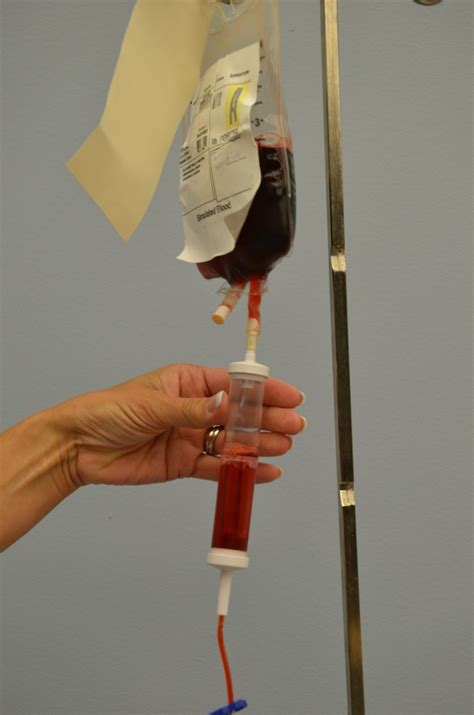 87 Transfusion Of Blood And Blood Products Clinical Procedures For