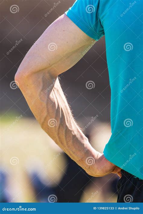 Large Veins In The Arms Of A Man Stock Image Image Of Background