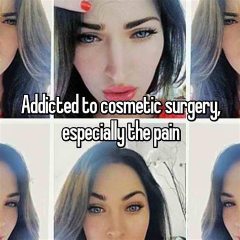people share their stories of addiction to plastic surgery