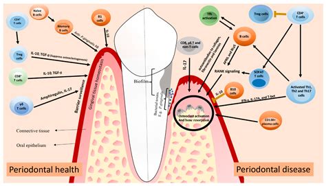Periodontal Health And Immune Response In Periodontitis Schematics Of
