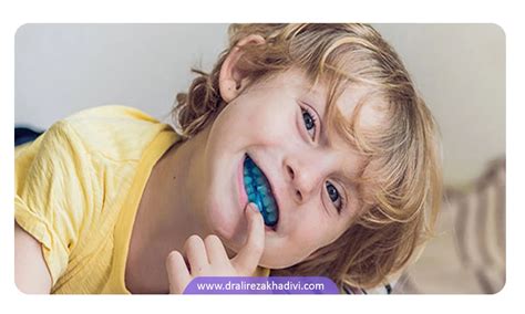 علت دندان قروچه کودکان در خواب و نحوه درمان آن دکتر خدیوی