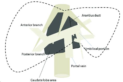 A Scheme Of The Caudate Lobe Area Download Scientific Diagram