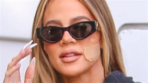 khloe kardashian reveals cheek bandage is from tumor removal cafe blouberg news