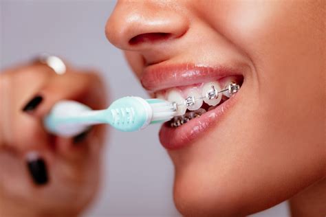 Oral Hygiene With Braces Caring For Your Braces
