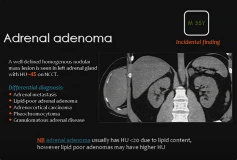 Dd Of Low Lipid Adrenal Lesions Adrenal Disease Adrenals Adrenal Glands