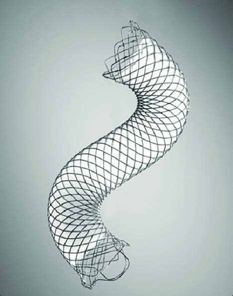 A Partially Covered Wallflex Stent The Image Was Used By Boston