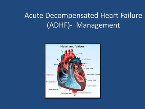 Acute Decompensated Heart Failure Ppt