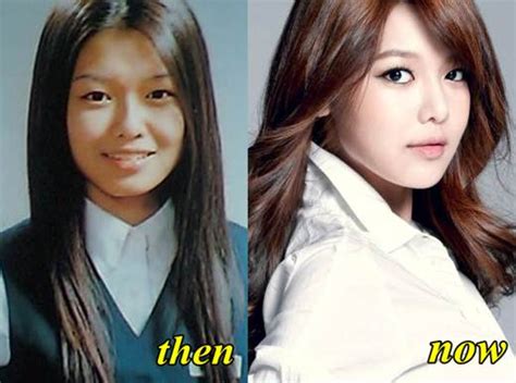 Girls Generation Snsd Plastic Surgery Before And After