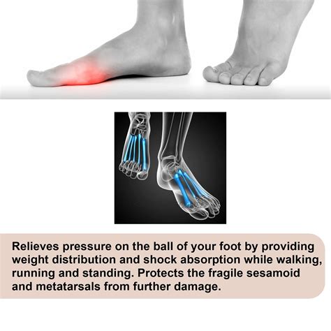Medipaq® Metatarsal Gel Protector Cushion Pads Relieve Ball Of Foot