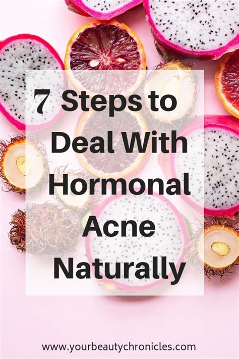 7 Steps To Deal With Hormonal Acne Your Beauty Chronicles Hormonal