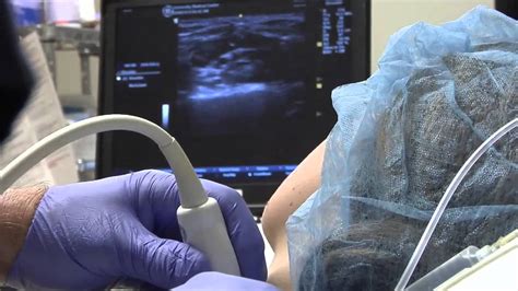 Ultrasound Guided Peripheral Nerve Blocks Arizona Healthbreak Youtube