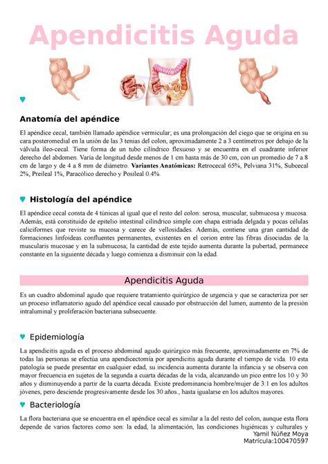Apendicitis Aguda Apendicitis Aguda Anatom A Del Ap Ndice El Ap Ndice Cecal Tambi N Llamado