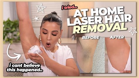 It includes the full pubic region, labia and perineal areas. I Tried At Home Laser Hair Removal & this happened ...