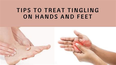 Eczema Tingling Sensation In Hands And Feet Causes And Treatment