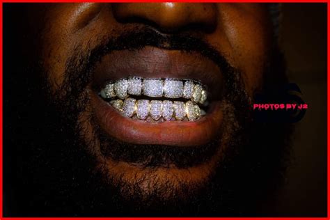 Good for your oral health. Used 10K Gold VVS Diamond Grillz for sale in Fort Worth - letgo