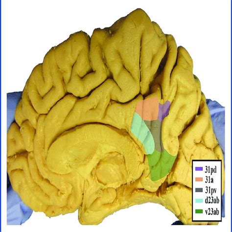 Anatomic View Of The Inferior Parietal Lobule And Tpoj Parcellations