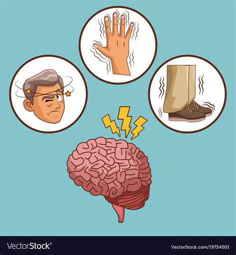 Parkinsons Disease Cartoon Royalty Free Vector Image