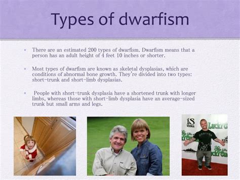 Ppt Dwarfism Powerpoint Presentation Id1885711