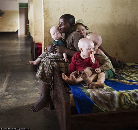 Tanzanias Albinos Relive Horror Of Their Limbs Being Stolen By