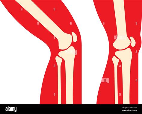 Human Knee Joint Vector Illustration Stock Vector Image And Art Alamy
