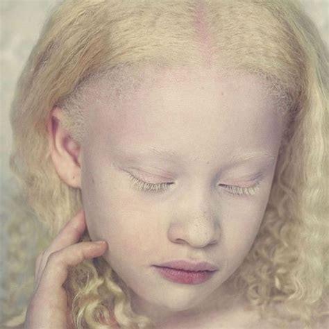 Pin Em Albinos