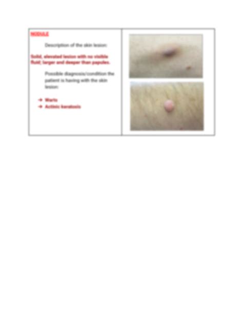 Solution Primary And Secondary Skin Lesions Studypool