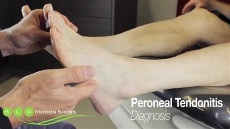 Https Youtube Com Watch V J Mhzgce Feature Share In Peroneal Tendonitis