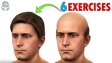 TOP 6 EXERCISES FOR HAIR GROWTH AND PREVENT BALDNESS NO SIDE EFFECTS