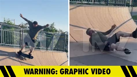 Gnarly Video Shows Bam Margera S Break Wrist After Skateboarding Fall