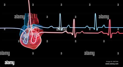 Human Heart With A Heartbeat Traces Hi Res Stock Photography And Images