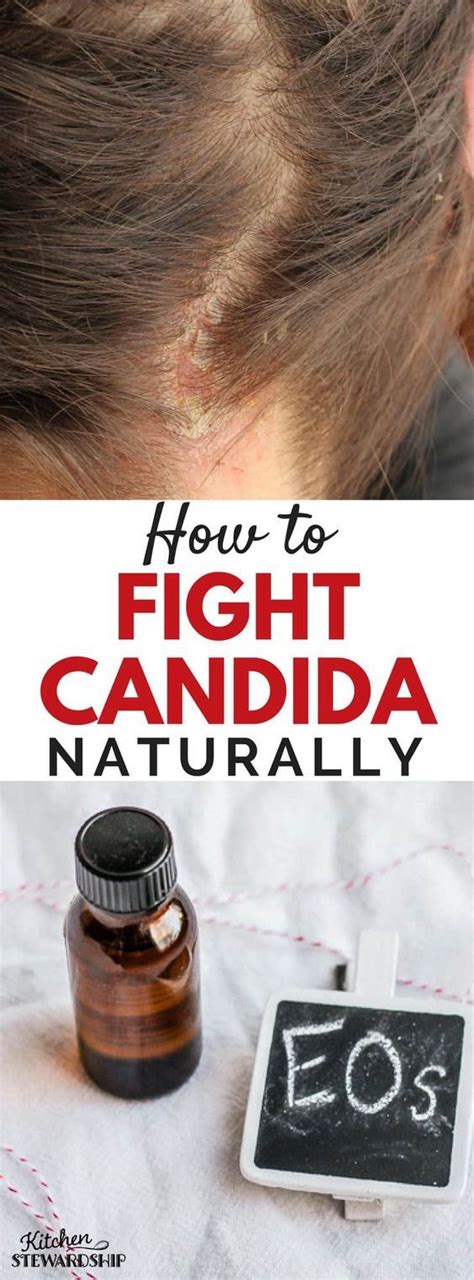 How To Fight Candida Naturally Natural Home Remedies Holistic