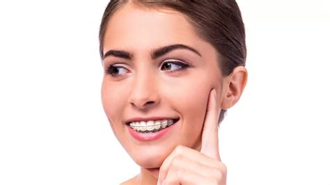 When Where How And Why To Use Wax For Braces Bruno Orthodontics
