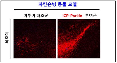 전형적인 파킨슨병 환자들은 몸통을 구부정하게 구부린 자세를 취하며, 보행을 시작하는데 어려움을 느끼고, 일단 보행을 시작하면 방향을 바꾸거나, 장애물을 피하거나, 정지하기가 어렵습니다. 셀리버리 "파킨슨병 치료신약, 운동능력 90% 회복 효과 ...