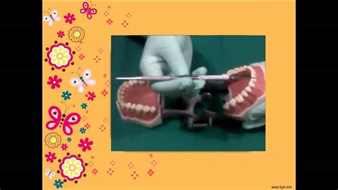 Operatoria Dental Instrumental Manual Y Aislamiento Absoluto Youtube