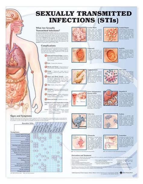 Sexually Transmitted Infections STIs Laminated Anatomical Chart 2nd